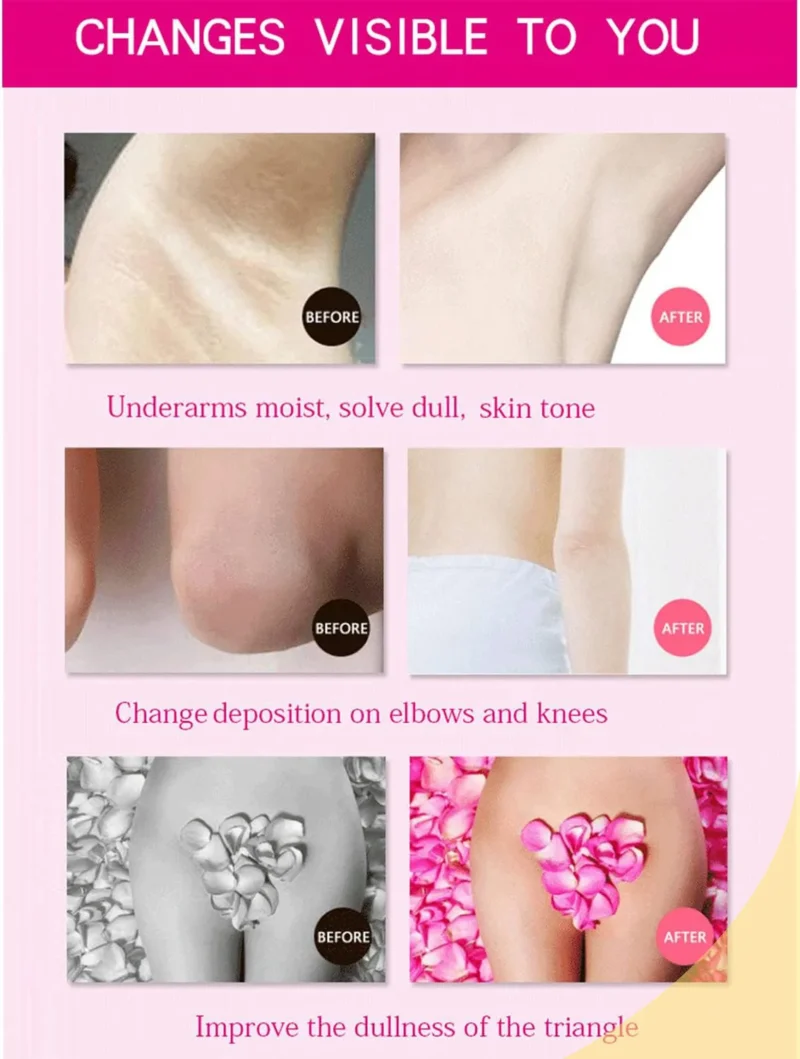 AICHUN BEAUTY Yogurt Underarm Cream - Image 7